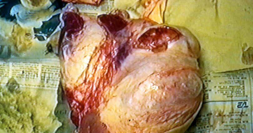 Obduktion af orne med smitsom kastning