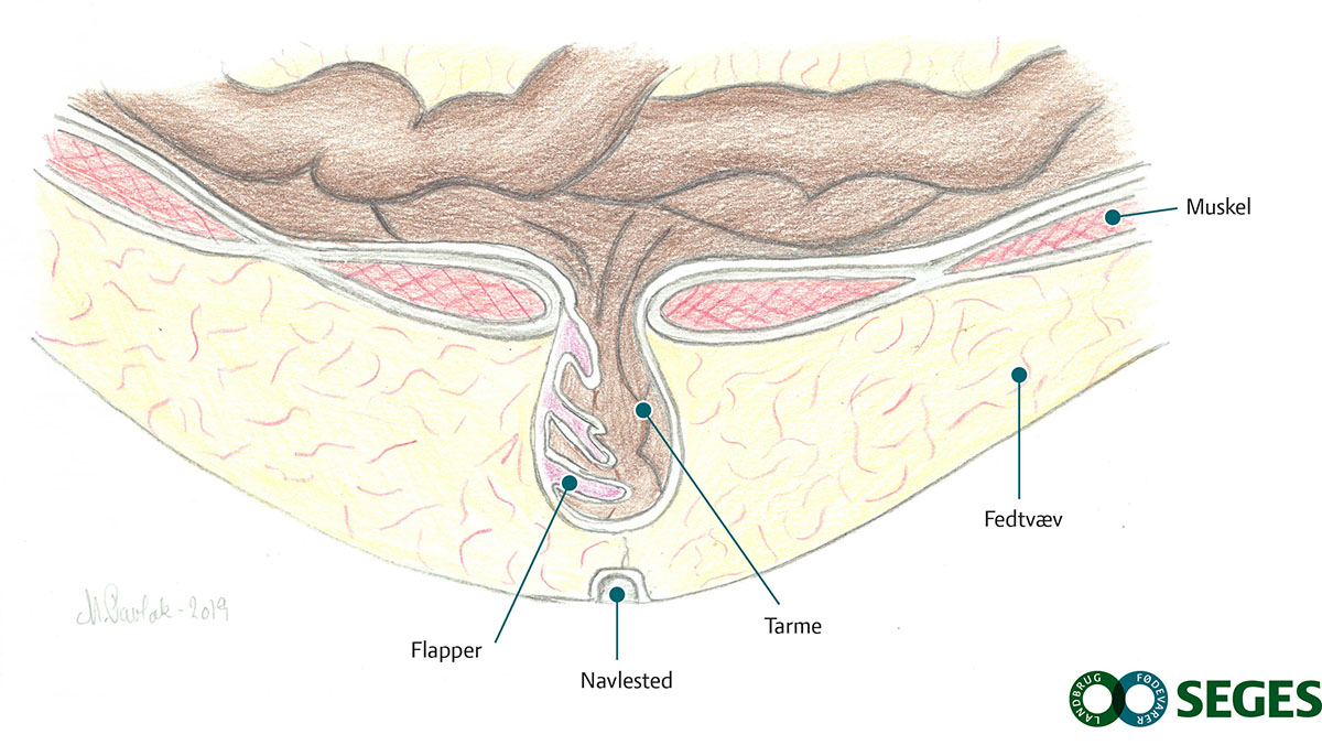 Flapper ved navlestedet hos en gris.